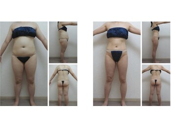 Nビューティー/最新エンダモロジーBODY