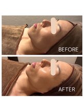 マーレ(Mare)/ララピール &nbsp;艶×白玉水光肌