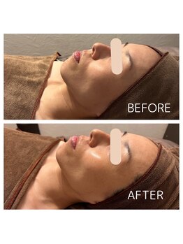 マーレ(Mare)/ララピール &nbsp;艶×白玉水光肌