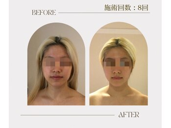 ビーキュート 渋谷北参道店(BE-CUTE)/お客様ビフォーアフター　２０代