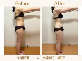 ヨサパーク ククナ 大塚(YOSA PARK kukuna)/痩身/ダイエット/よもぎ蒸し痩身