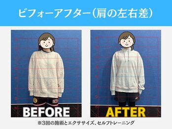キャリッジスポーツ 盛岡(Carriage Sports)/ビフォーアフター【方の左右差】