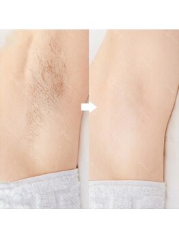 ファウンデーション(FOUNDATION)/見せられない!を解消