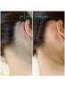 【WAX脱毛】女性えりあしワックス¥3600★ムダ毛撃退！すっきりアップヘア
