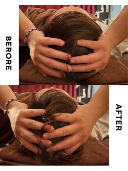 ソンディー(Sondy)/小顔矯正でスッキリ！