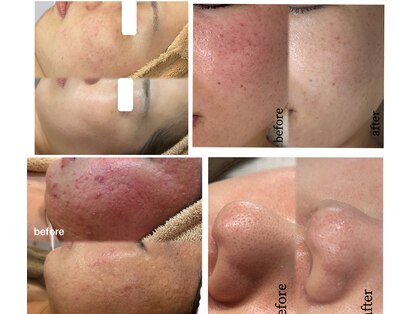 ベリス(BELLIS)の写真