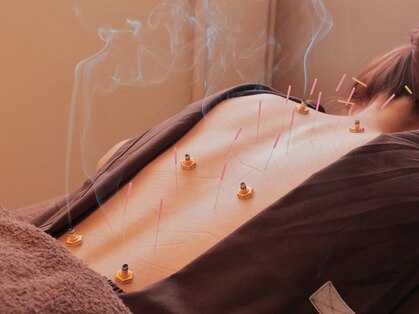 菫鍼灸院の写真