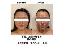 ラナン パラフューズ(Ranun's PARAFUSE.)/体重の変化がないのにスッキリ♪