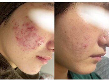 アネル うるま店(anel)/