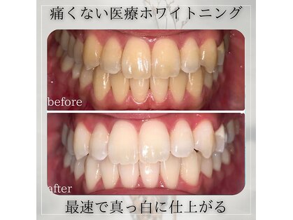 ホワイトニングビューティー つくば店の写真