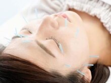 グレース鍼灸院 整骨院 ひたちなか