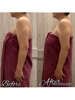 B.B藤沢 レオスタイル(LeoStyle)/NR筋膜リリース