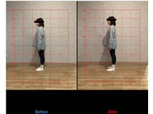 リード整骨院(LEAD整骨院)/デスクワーク#眼圧#猫背#首こり