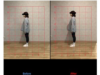 リード整骨院(LEAD整骨院)/デスクワーク#眼圧#猫背#首こり