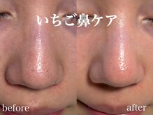 ネオリー(neorii)/いちご鼻ケア　水素水毛穴洗浄