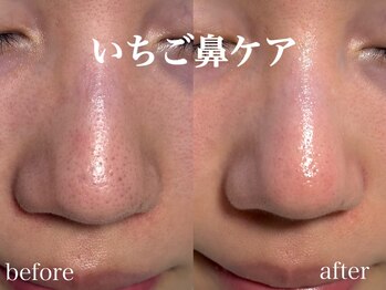 ネオリー(neorii)/いちご鼻ケア　水素水毛穴洗浄