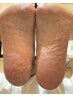 【FOOT】かかと角質ケア&爪の甘皮処理