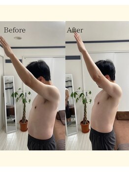 ハリトト鍼灸院/鍼灸 施術例 50代男性