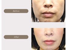 ムーンライズ(moonrise)/