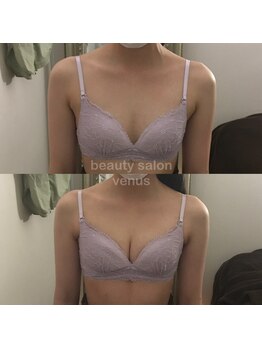 ヴィーナス(Venus)/バストアップで鎖骨美人にも!