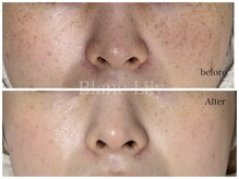 ブランリリー(Blanc Lily)の雰囲気(経験人数が信頼の証。施術実績4,800名以上肌を見てきました!)