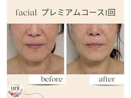 パーソナル ユニ(uni)の写真