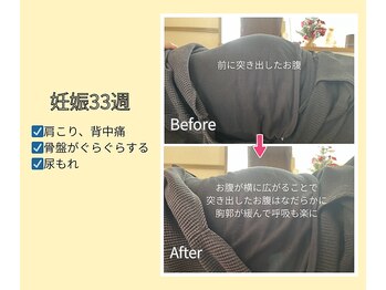 ルーナサナ(Luna sana)/妊娠３３週/お腹の形の変化
