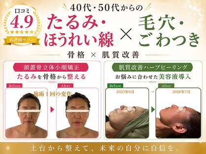 スカイ(sky)の写真