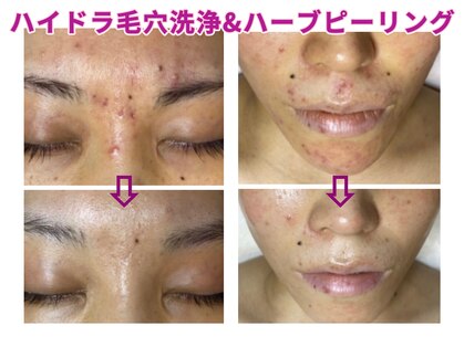 ジナ ビューティ(GINA BEAUTY)の写真