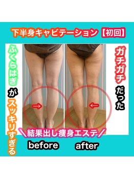 ビューティ ウィッチ(Beauty Witch)/