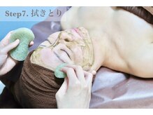 ノーブル 新宿南口(NOBLE)/剥離ハーブピーリング　工程７