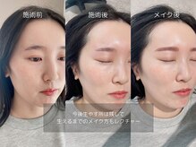 リア 自由が丘(REA)/眉毛ワックス