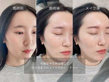 リア 自由が丘(REA)/眉毛ワックス