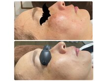 サイエンスビューティー ケイ ティ(K T)の雰囲気（★プラズマ★初回￥6000★   シミ、シワ、ハリ改善プログラム）