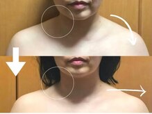 カルニッコ(Kalnicco)の雰囲気（こわばった頑固な首肩こりをケアすると見た目も体感もスッキリ）