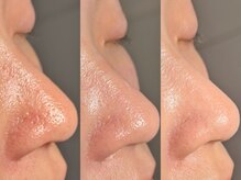 ルーナジェーナ(Luna llena)/