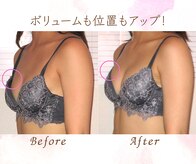 バストサロン メルベイユ(Merveile)