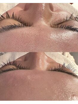 クラルス(Clarus)/フェイシャルwax