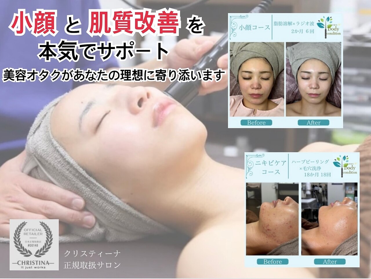 ボディコンディション｜ホットペッパービューティー