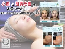 ボディコンディション