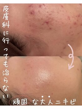 ビジュープラス ひたち野うしく店(Bijou+)/