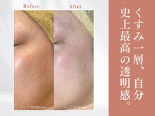 トリートメントサロンビューティープラス(Treatment Salon Beauty+)/