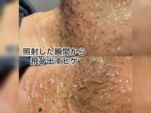 モデルズ(MODELS)の雰囲気（【ヒゲ脱毛】元祖飛び出すヒゲの発祥#ヒゲ脱毛松山）