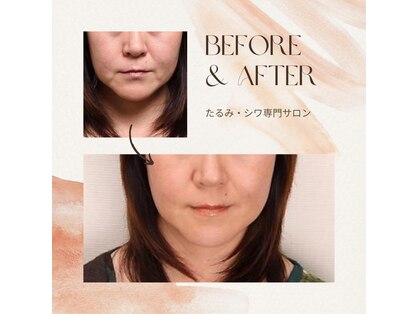 ベール(Belle)の写真