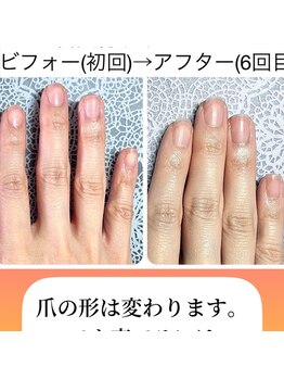 桃の木 吉祥寺店/#自爪育成　1