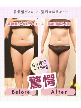 ベルダ(Beldad)/骨盤矯正でスタイルアップ