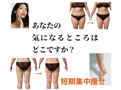 ヨサパーク 日葵(YOSA PARK)の写真