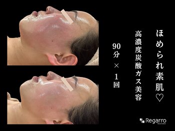 レガロビューティクリエイションズ桜川店/もう悩まない！肌荒れ改善