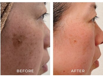 ルーメ(lume)/30代女性