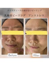 メゾン カルム 天文館店(MAISON CALME)/肌質改善